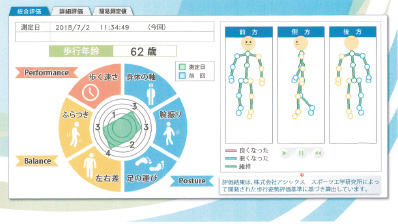 Walking posture diagnosis results